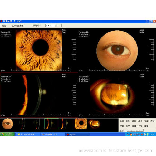 Patients Database / Pacs for Slit Lamp/ Ab Scan/ Slit Lamp/ Surgical Microscopes
